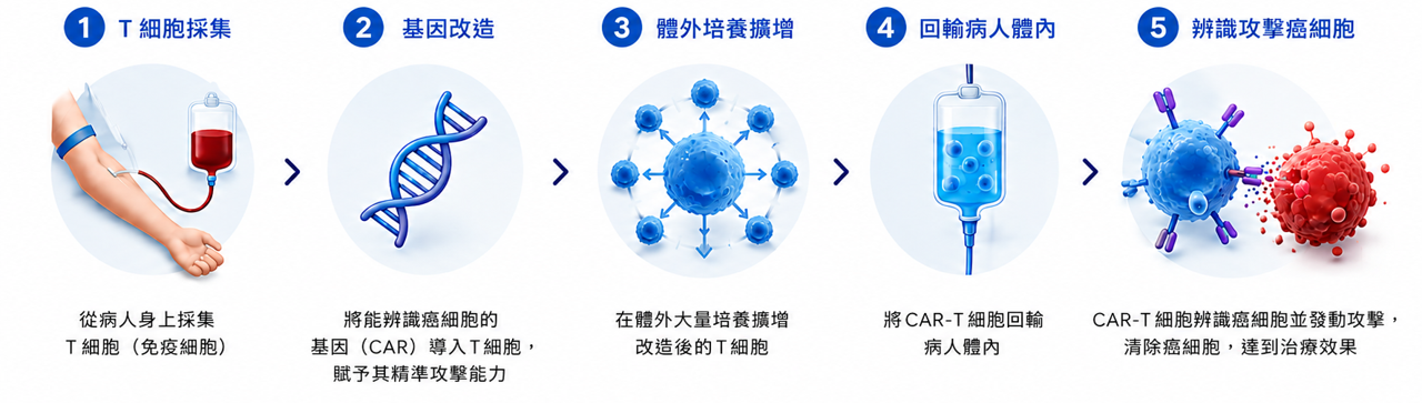 CAR-T 細胞治療流程